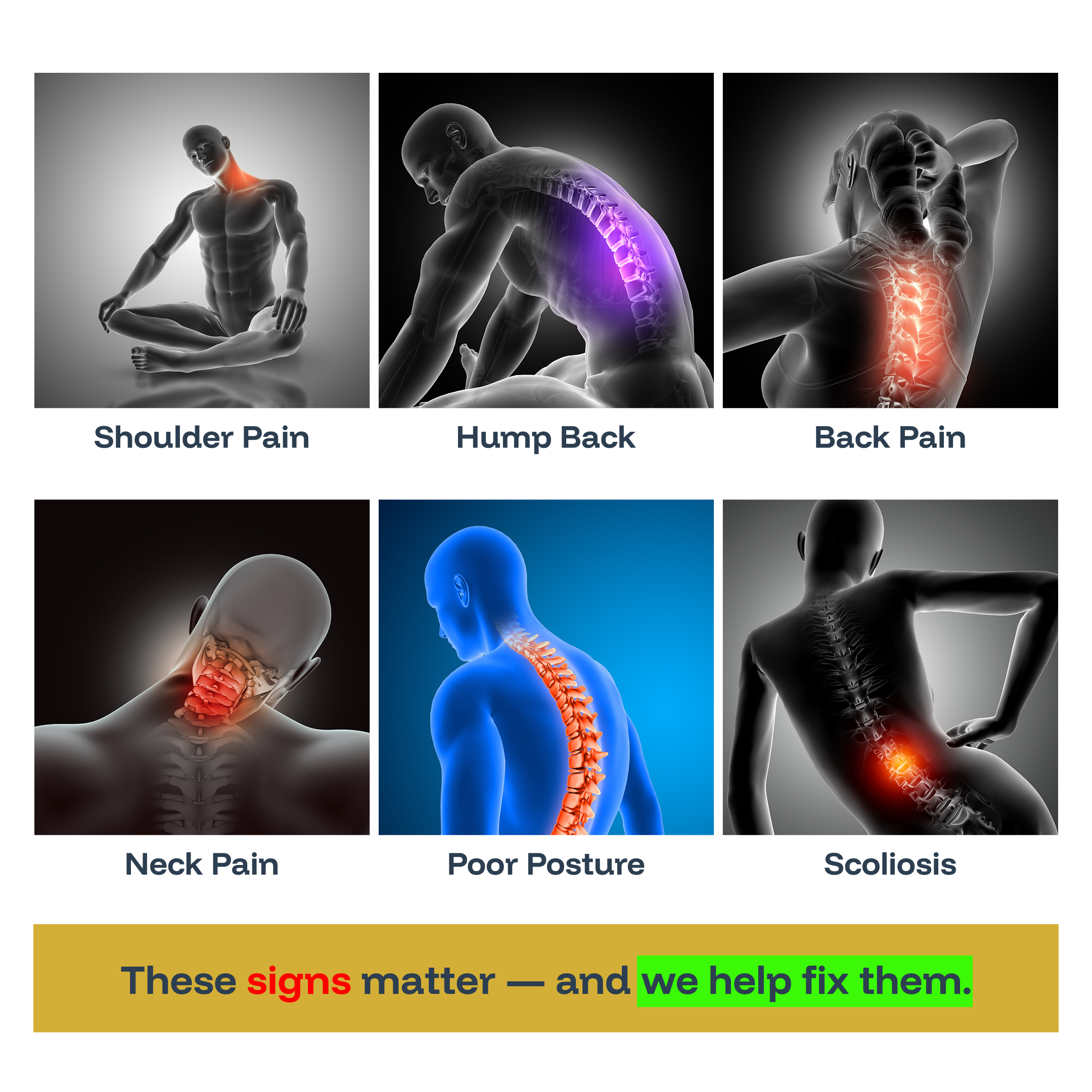 Posture PRO+ (Adjustable Posture Corrector Belt)